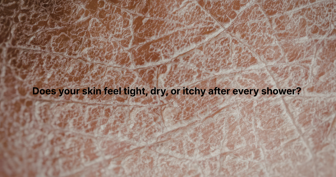 dry, itchy skin after shower